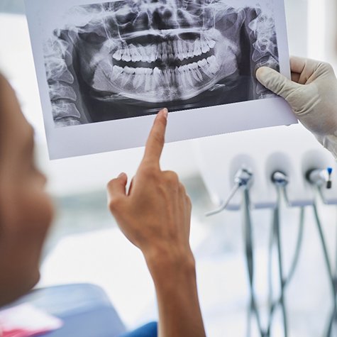 Dentist and patient looking at X-ray discussing advanced dental implant procedures