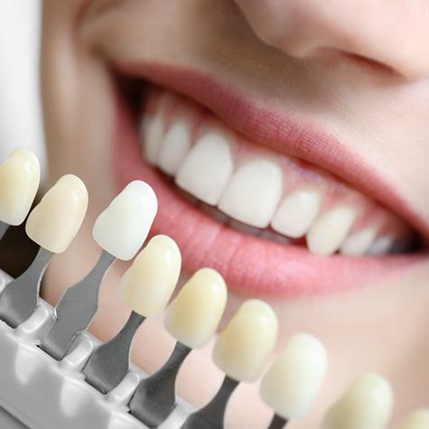 Shade guide for teeth whitening