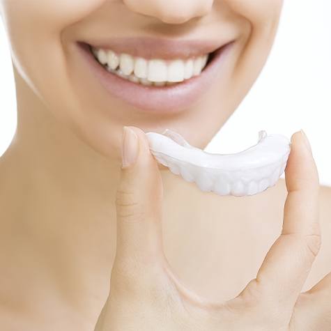 Woman placing take-home teeth whitening tray